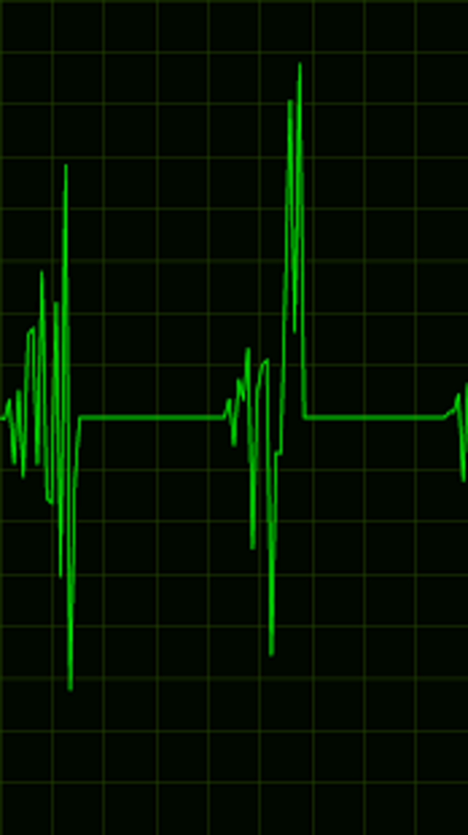 Heartbeat Live Wallpaper, Picture