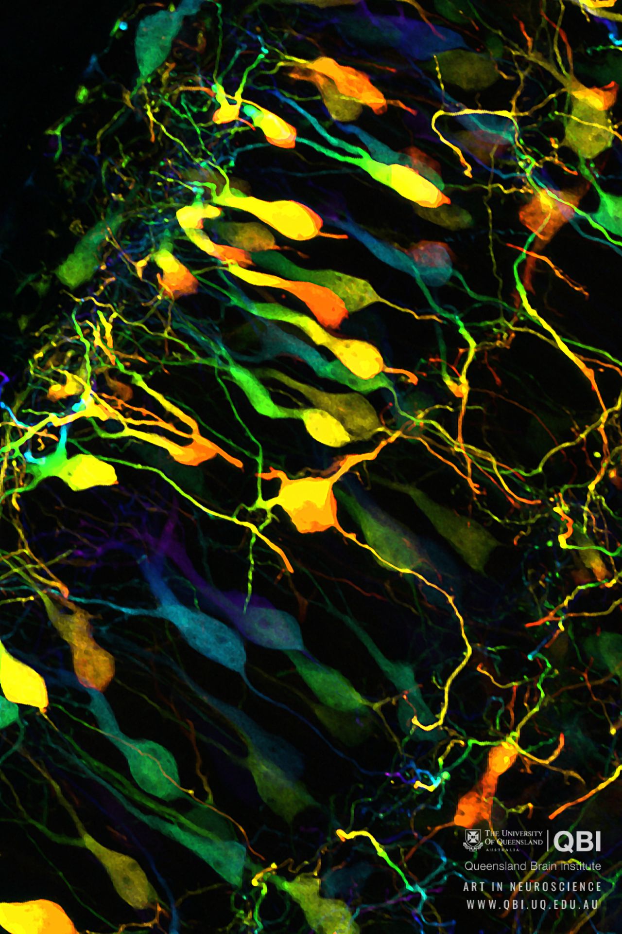 Best neuroscience image of 2016 Brain Institute