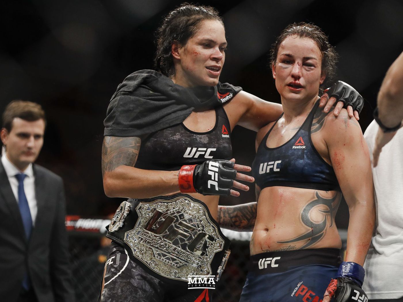 Amanda Nunes: Raquel Pennington's coaches 'failed' at UFC 224