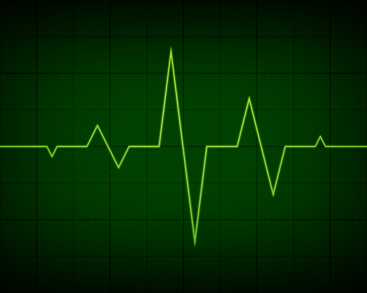 Free download Cardiology Wallpaper Electrocardiogram wallpaper [2560x1600] for your Desktop, Mobile & Tablet. Explore Cardiology Wallpaper. Cardiology Wallpaper