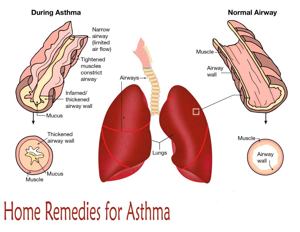 Home Remedies For Asthma. Science & Technology, Islam, Urdu English Dictionary, Events