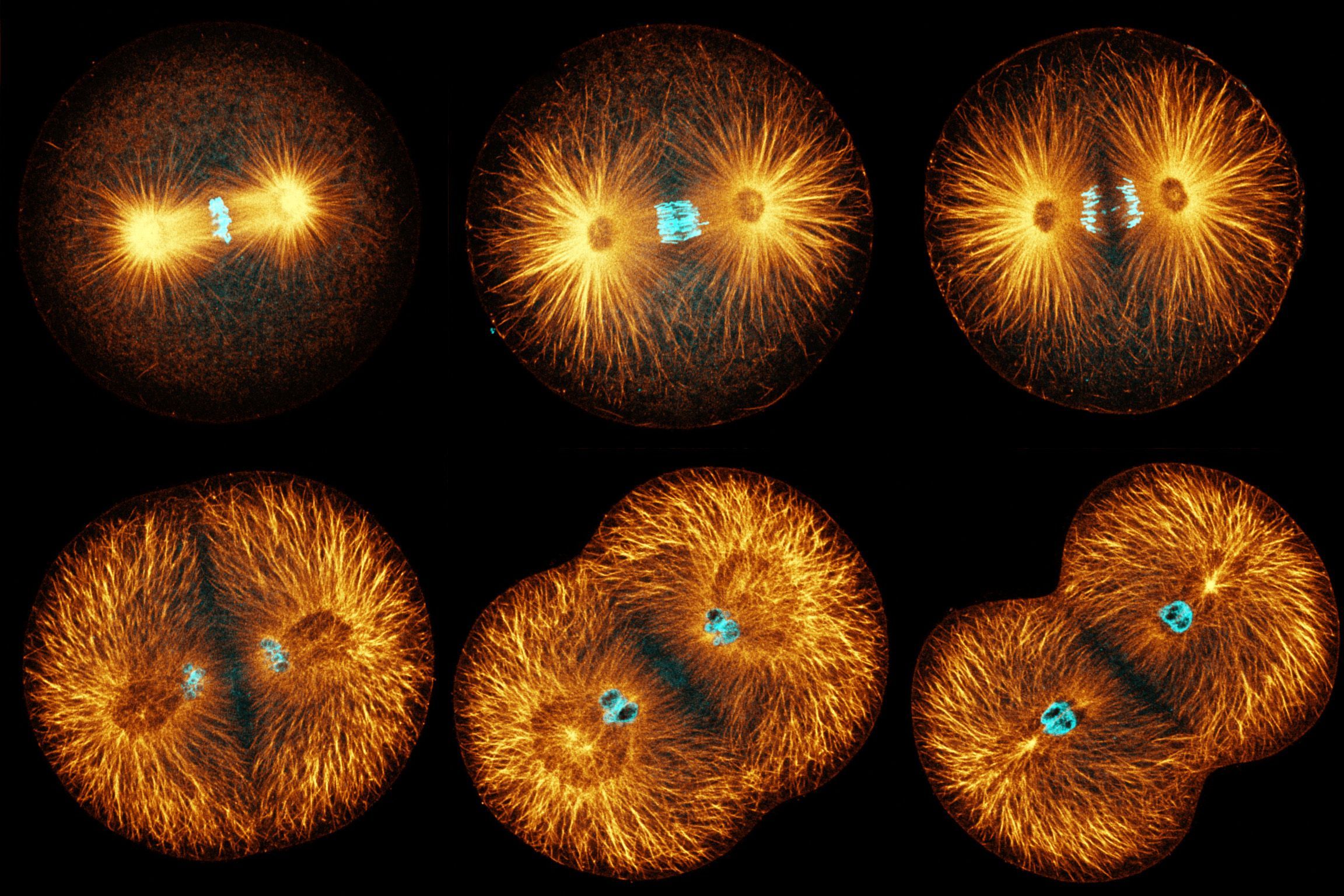 Human Cell Division Under The Microscope Mitosis Cells Close Up 3d  Illustration Stock Photo - Download Image Now - iStock