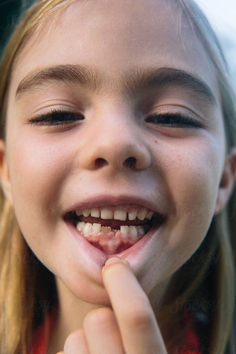 Lost Tooth Wallpapers - Wallpaper Cave