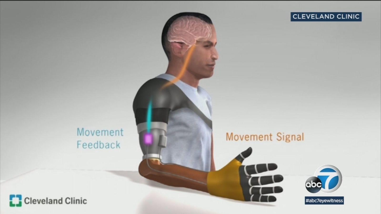 Scientists make bionic prosthetic arm .abc7.com