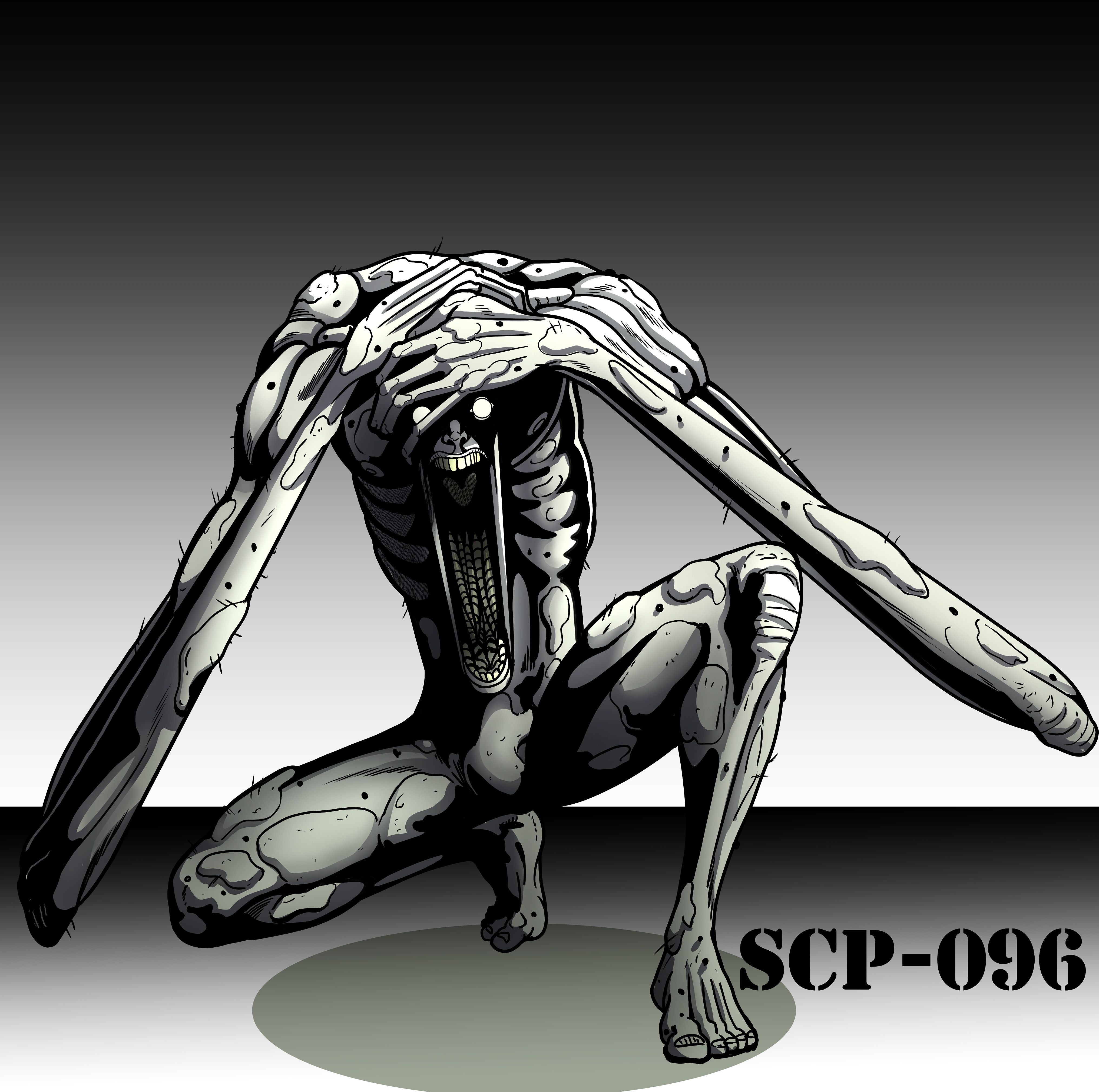 Scp 096