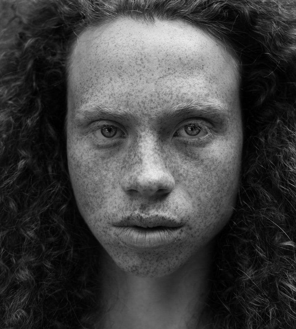 Freckles Picture [HD]. Download Free Image