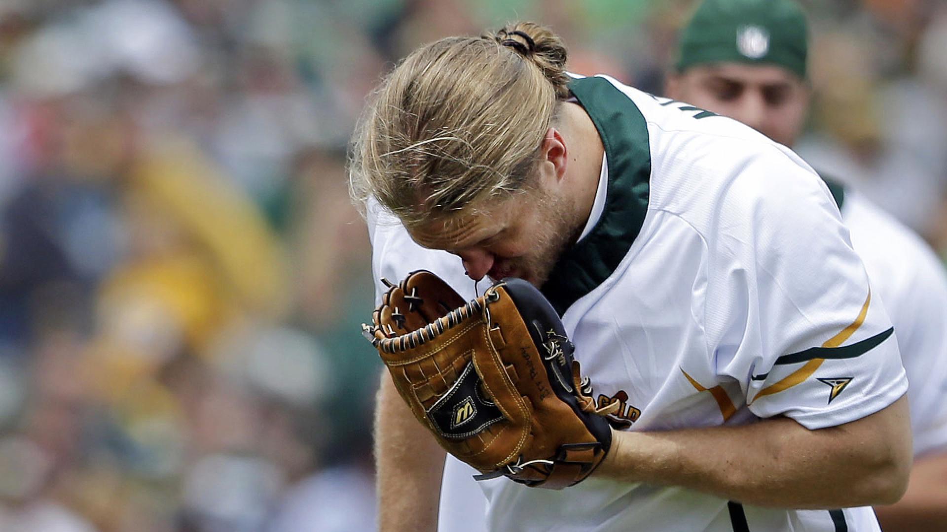 Green Bay Packers' Clay Matthews suffers broken nose in softball game