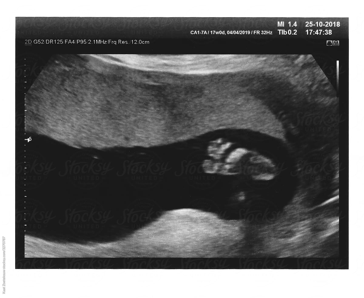 Ultrasound Wallpapers - Wallpaper Cave