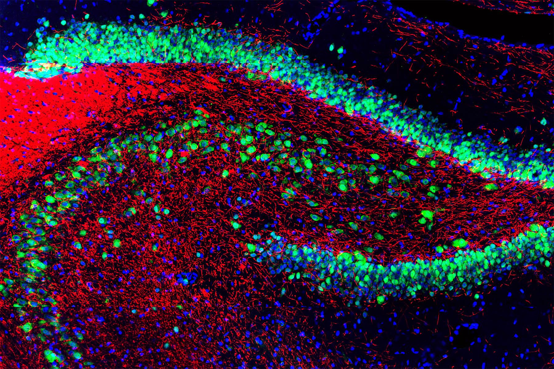 Rat hippocampus stained with antibody to NeuN (green), myelin basic protein (red) and DNA (blue)