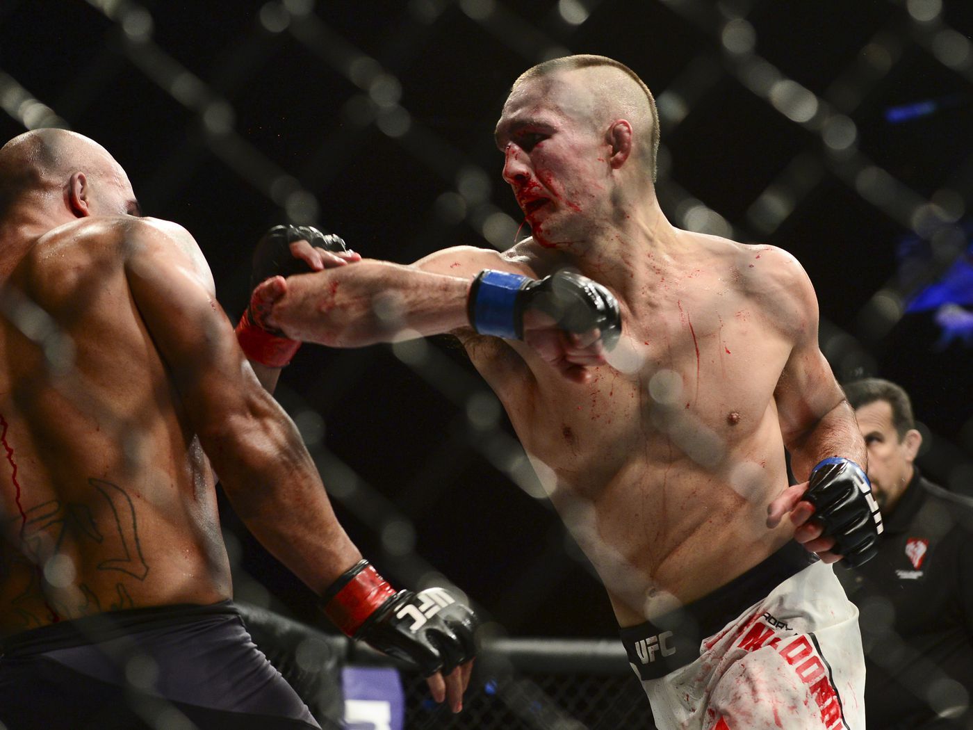 Photos: Rory MacDonald and Robbie Lawler's faces, a day after UFC 189 war