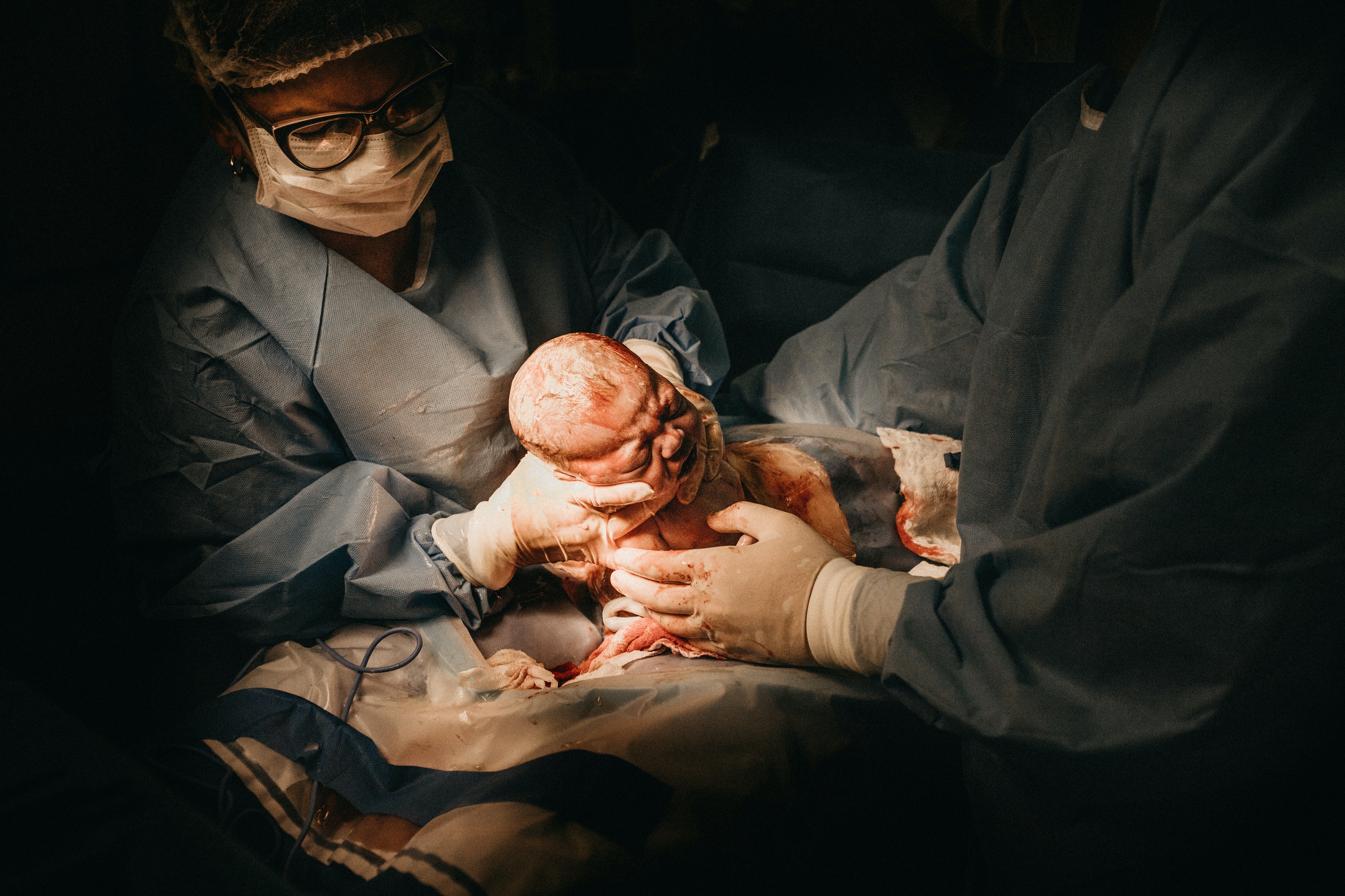 Woman Giving Birth To Baby Via C Section · Free