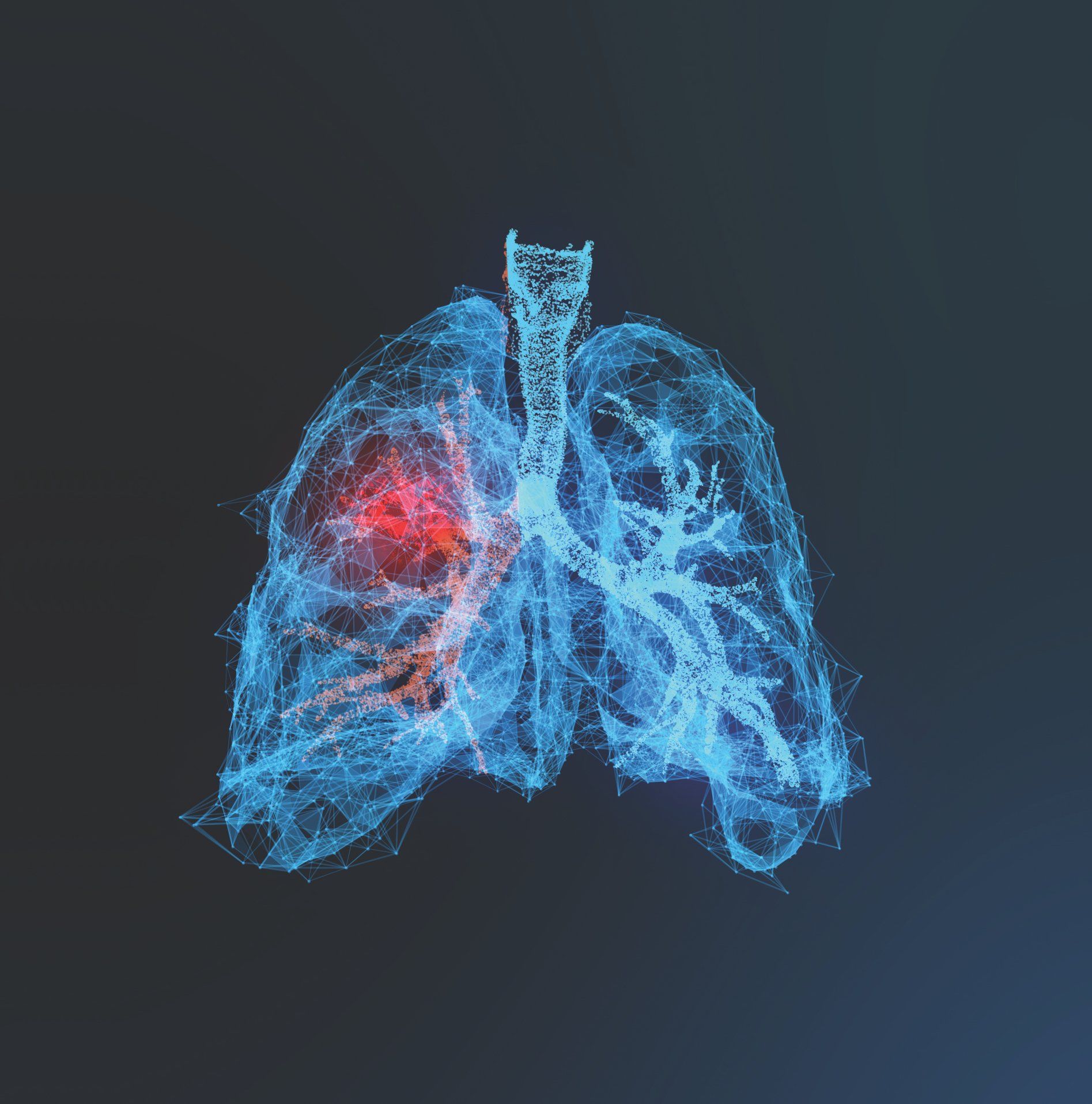 Diagnostic AI Tool For Identifying Early Stage Lung Cancer Earns FDA 150(k) Clearance
